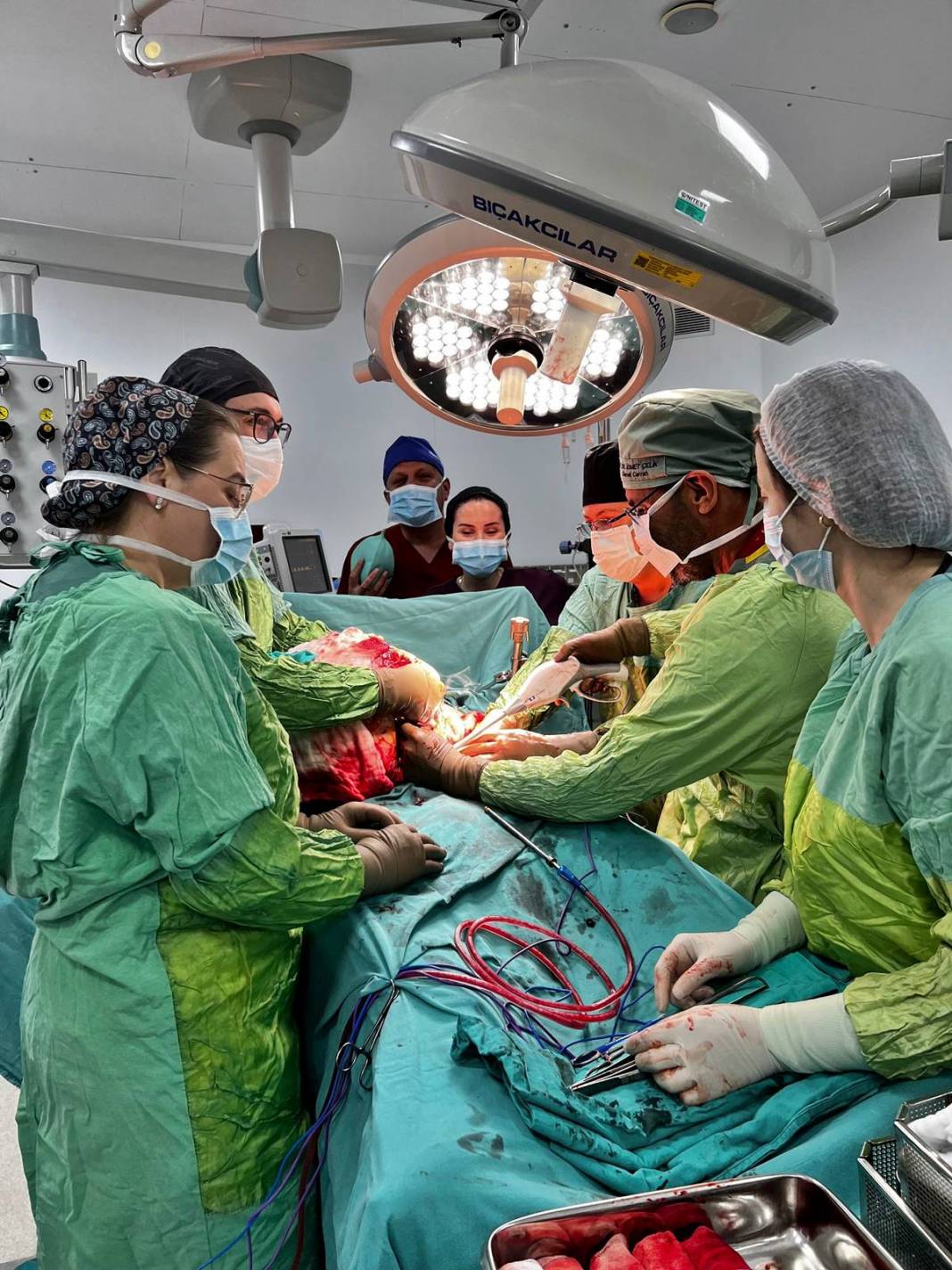 Doktor şaştı kaldı: Bu kadar büyüğünü daha önce görmedim! Hastanın karnından çıkan dev tümör şoke etti 2